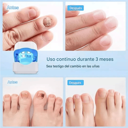 BrillaUña - Brillo Natural